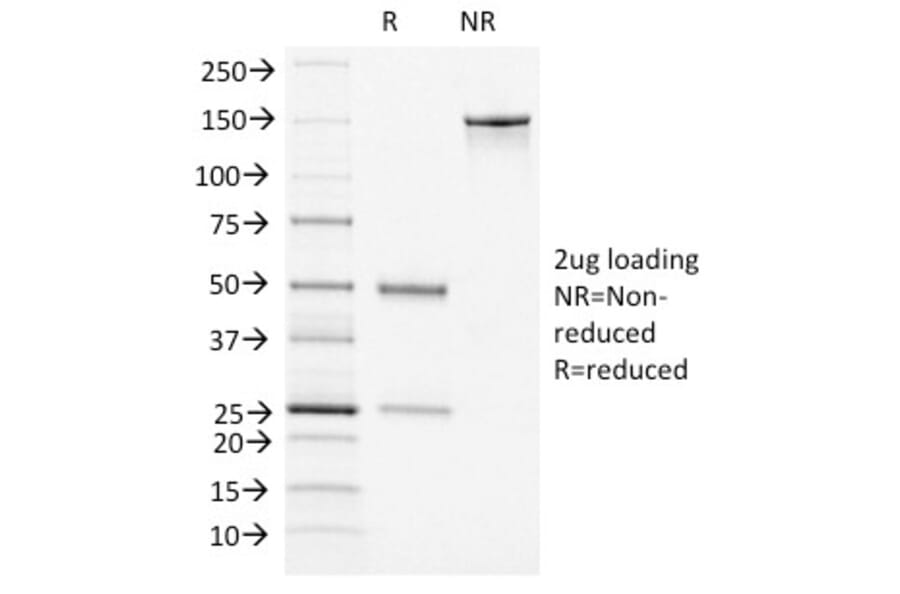 SDS-PAGE - Anti-Von Willebrand Factor Antibody [VWF/1465] - BSA and Azide free (A253505) - Antibodies.com