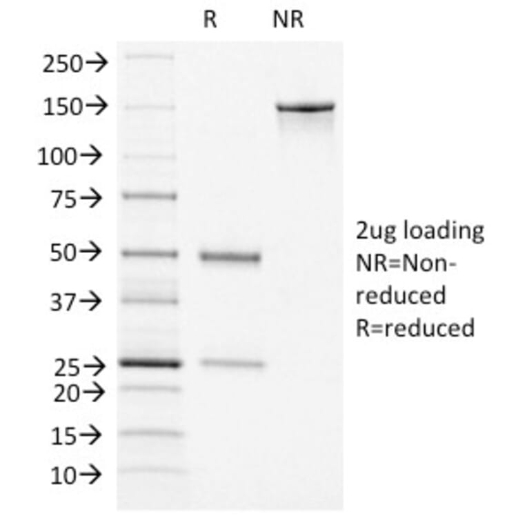 SDS-PAGE - Anti-Von Willebrand Factor Antibody [VWF/1465] - BSA and Azide free (A253505) - Antibodies.com