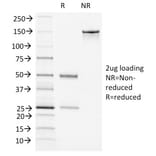 SDS-PAGE - Anti-Von Willebrand Factor Antibody [VWF/1465] - BSA and Azide free (A253505) - Antibodies.com