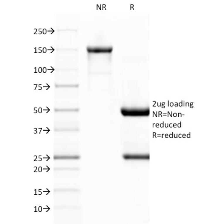 SDS-PAGE - Anti-Von Willebrand Factor Antibody [VWF/1767] - BSA and Azide free (A253507) - Antibodies.com