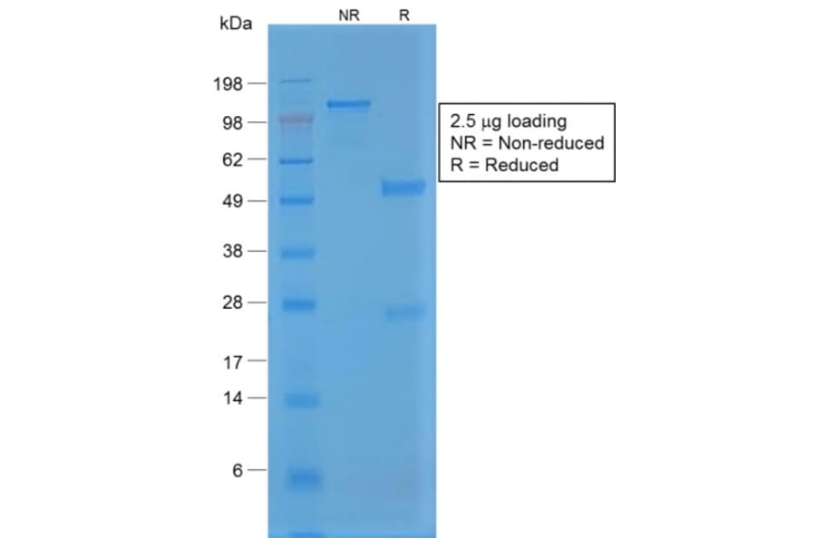 SDS-PAGE - Anti-Von Willebrand Factor Antibody [VWF/1859R] - BSA and Azide free (A253509) - Antibodies.com