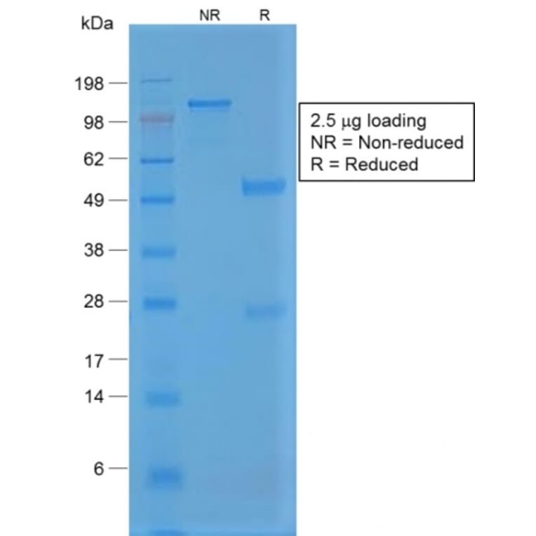 SDS-PAGE - Anti-Von Willebrand Factor Antibody [VWF/1859R] - BSA and Azide free (A253509) - Antibodies.com