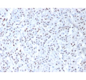 Immunohistochemistry - Anti-Wilms Tumor Protein Antibody [6F-H2] - BSA and Azide free (A253509) - Antibodies.com