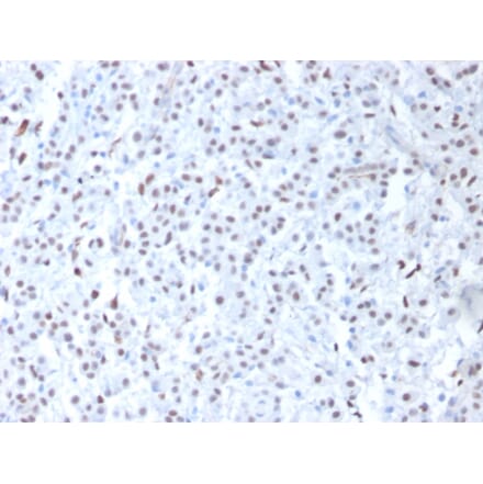 Immunohistochemistry - Anti-Wilms Tumor Protein Antibody [6F-H2] - BSA and Azide free (A253509) - Antibodies.com