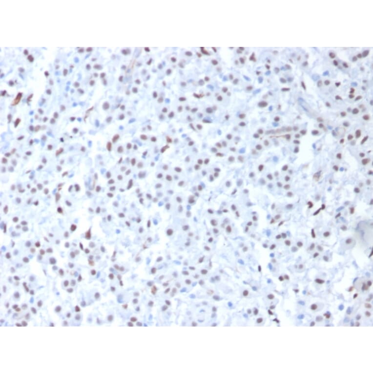 Immunohistochemistry - Anti-Wilms Tumor Protein Antibody [6F-H2] - BSA and Azide free (A253509) - Antibodies.com