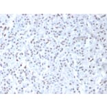 Immunohistochemistry - Anti-Wilms Tumor Protein Antibody [6F-H2] - BSA and Azide free (A253509) - Antibodies.com