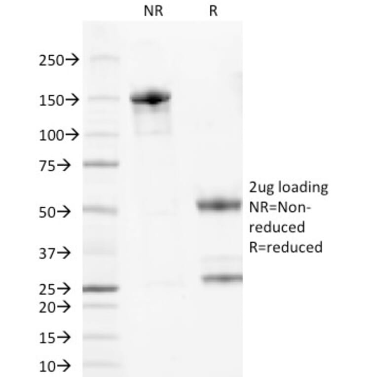 SDS-PAGE - Anti-Wilms Tumor Protein Antibody [6F-H2] - BSA and Azide free (A253510) - Antibodies.com