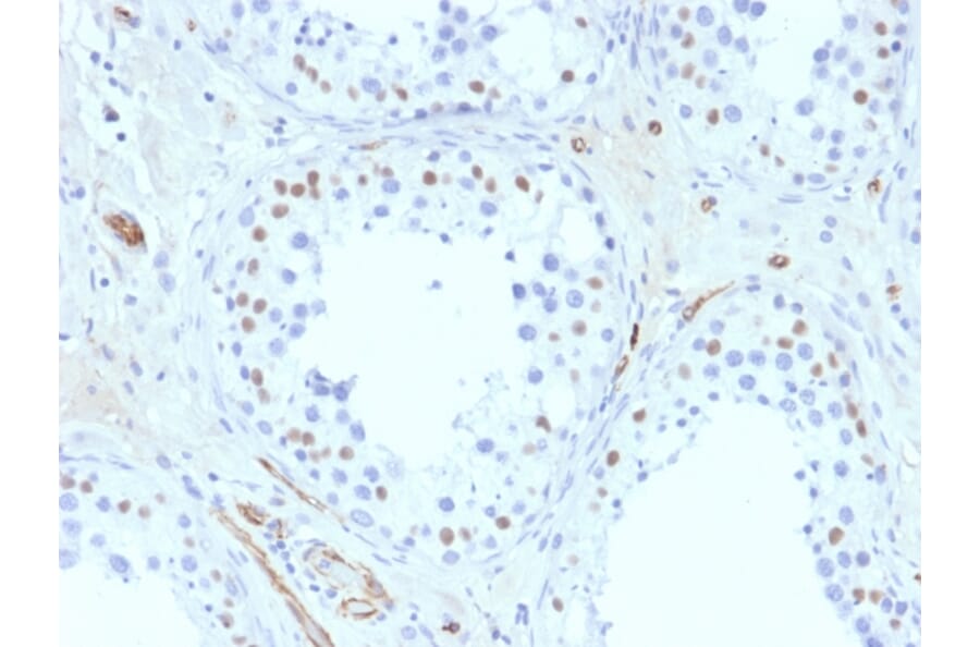 Immunohistochemistry - Anti-Wilms Tumor Protein Antibody [6F-H2] - BSA and Azide free (A253510) - Antibodies.com