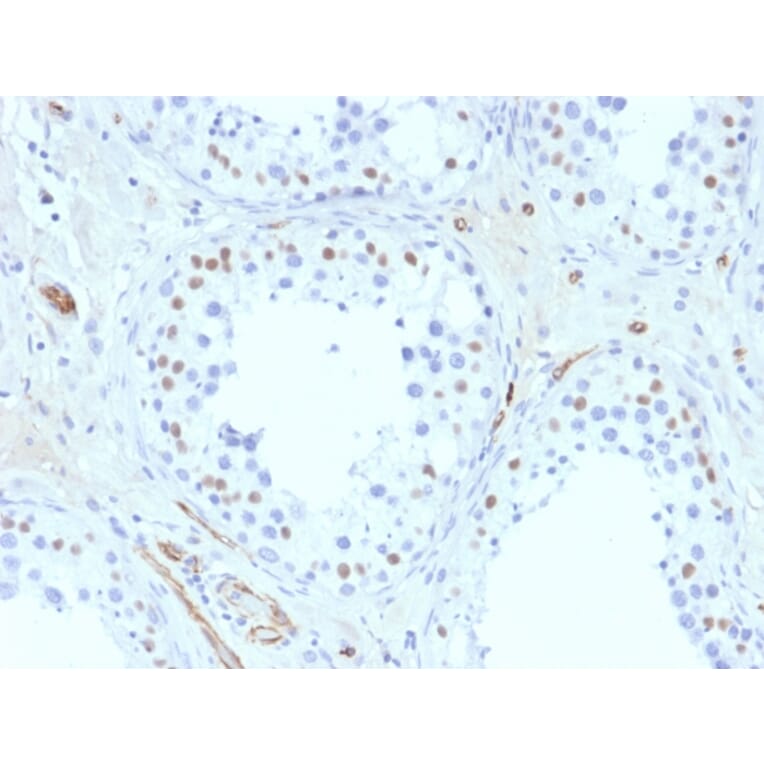 Immunohistochemistry - Anti-Wilms Tumor Protein Antibody [6F-H2] - BSA and Azide free (A253510) - Antibodies.com