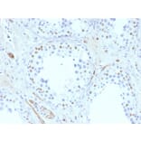 Immunohistochemistry - Anti-Wilms Tumor Protein Antibody [6F-H2] - BSA and Azide free (A253510) - Antibodies.com