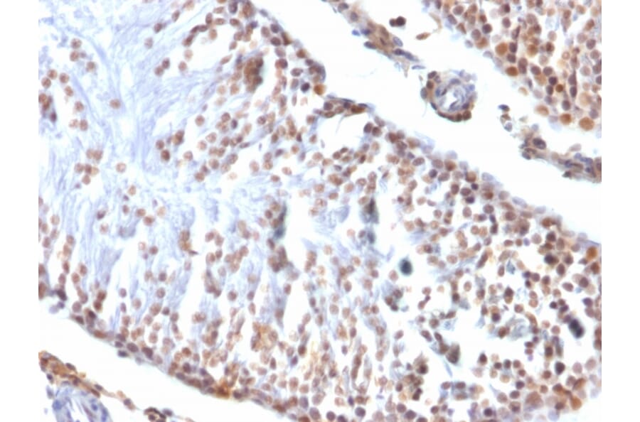 Immunohistochemistry - Anti-Wilms Tumor Protein Antibody [6F-H2] - BSA and Azide free (A253510) - Antibodies.com