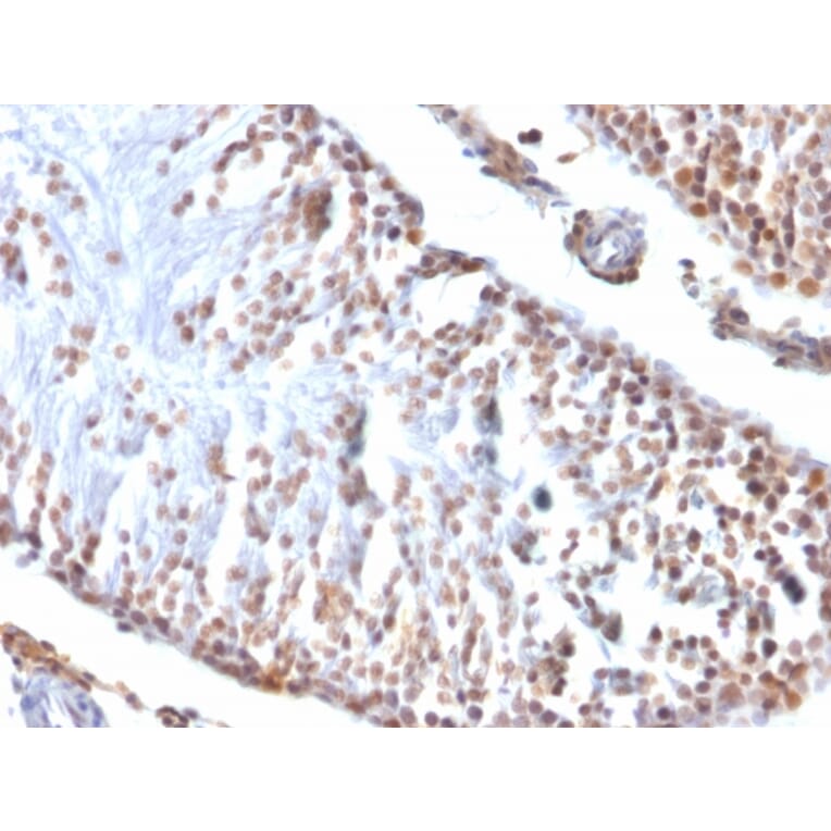 Immunohistochemistry - Anti-Wilms Tumor Protein Antibody [6F-H2] - BSA and Azide free (A253510) - Antibodies.com