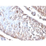 Immunohistochemistry - Anti-Wilms Tumor Protein Antibody [6F-H2] - BSA and Azide free (A253510) - Antibodies.com