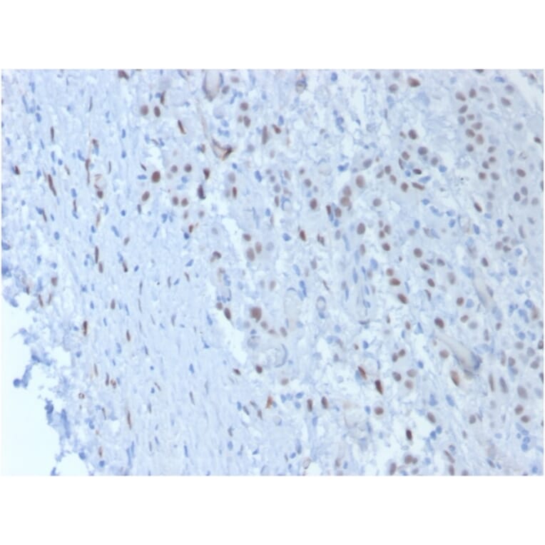 Immunohistochemistry - Anti-Wilms Tumor Protein Antibody [SPM361] - BSA and Azide free (A253510) - Antibodies.com