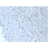 Immunohistochemistry - Anti-Wilms Tumor Protein Antibody [SPM361] - BSA and Azide free (A253510) - Antibodies.com