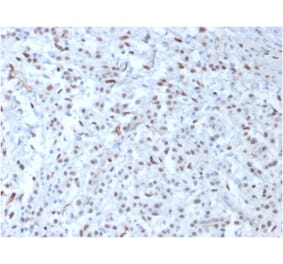 Immunohistochemistry - Anti-Wilms Tumor Protein Antibody [WT1/857] - BSA and Azide free (A253511) - Antibodies.com