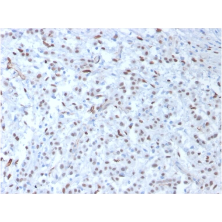 Immunohistochemistry - Anti-Wilms Tumor Protein Antibody [WT1/857] - BSA and Azide free (A253511) - Antibodies.com