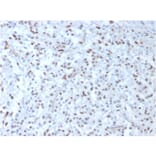 Immunohistochemistry - Anti-Wilms Tumor Protein Antibody [WT1/857] - BSA and Azide free (A253511) - Antibodies.com