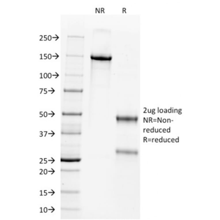 SDS-PAGE - Anti-Wilms Tumor Protein Antibody [WT1/857] - BSA and Azide free (A253512) - Antibodies.com