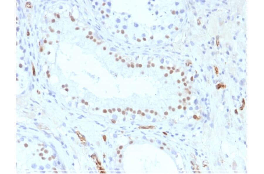 Immunohistochemistry - Anti-Wilms Tumor Protein Antibody [WT1/857] - BSA and Azide free (A253512) - Antibodies.com