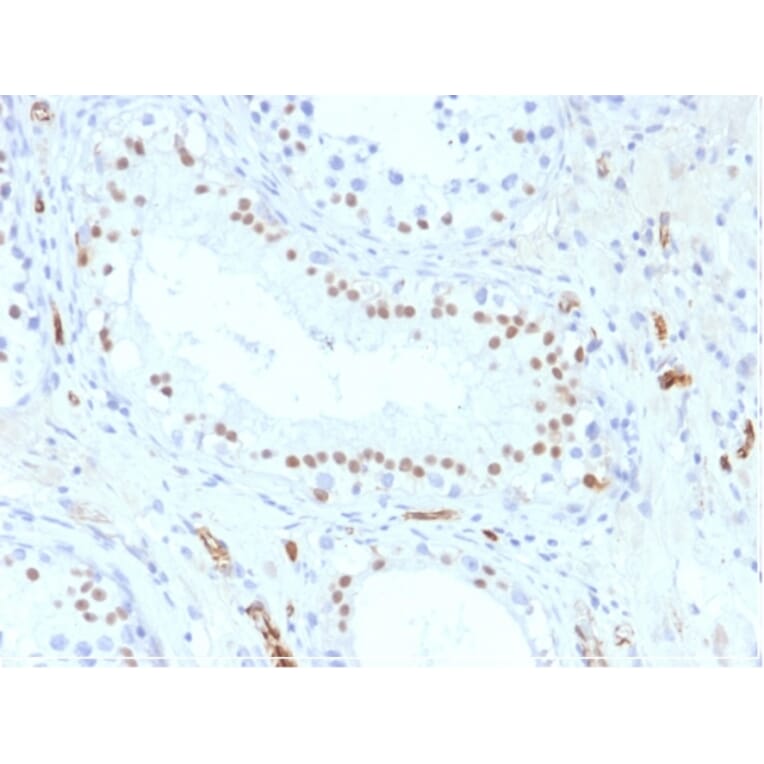 Immunohistochemistry - Anti-Wilms Tumor Protein Antibody [WT1/857] - BSA and Azide free (A253512) - Antibodies.com