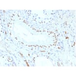 Immunohistochemistry - Anti-Wilms Tumor Protein Antibody [WT1/857] - BSA and Azide free (A253512) - Antibodies.com