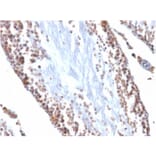 Immunohistochemistry - Anti-Wilms Tumor Protein Antibody [WT1/857] - BSA and Azide free (A253512) - Antibodies.com