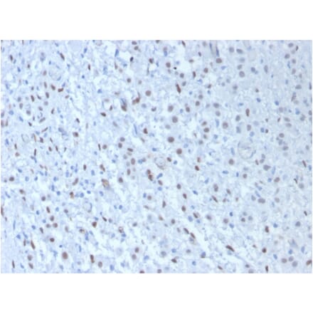 Immunohistochemistry - Anti-Wilms Tumor Protein Antibody [WT1/857 + 6F-H2] - BSA and Azide free (A253512) - Antibodies.com