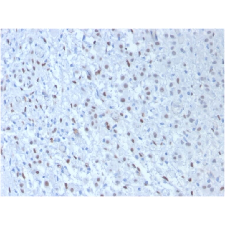 Immunohistochemistry - Anti-Wilms Tumor Protein Antibody [WT1/857 + 6F-H2] - BSA and Azide free (A253512) - Antibodies.com