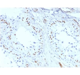 Immunohistochemistry - Anti-Wilms Tumor Protein Antibody [rWT1/857] - BSA and Azide free (A253514) - Antibodies.com