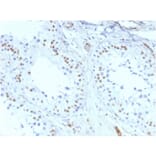 Immunohistochemistry - Anti-Wilms Tumor Protein Antibody [rWT1/857] - BSA and Azide free (A253514) - Antibodies.com