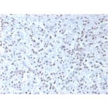 Immunohistochemistry - Anti-Wilms Tumor Protein Antibody [rWT1/857] - BSA and Azide free (A253514) - Antibodies.com