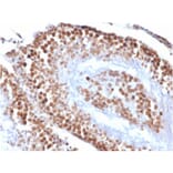 Immunohistochemistry - Anti-Wilms Tumor Protein Antibody [rWT1/857] - BSA and Azide free (A253514) - Antibodies.com