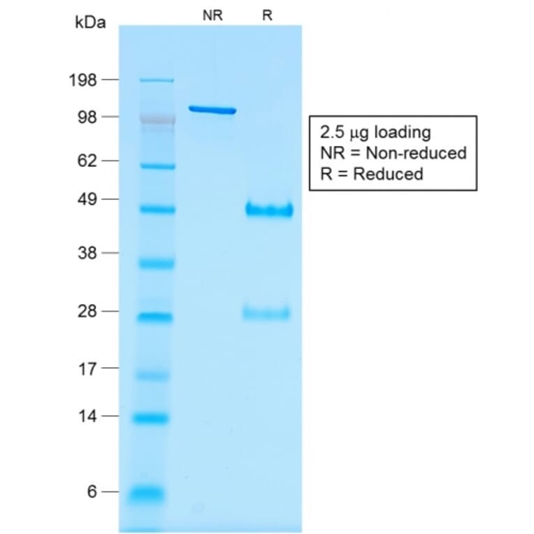 SDS-PAGE - Anti-Wilms Tumor Protein Antibody [rWT1/857] - BSA and Azide free (A253514) - Antibodies.com