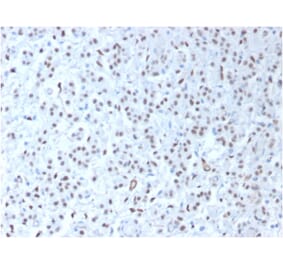 Immunohistochemistry - Anti-Wilms Tumor Protein Antibody [WT1/1434R] - BSA and Azide free (A253514) - Antibodies.com