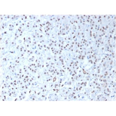 Immunohistochemistry - Anti-Wilms Tumor Protein Antibody [WT1/1434R] - BSA and Azide free (A253514) - Antibodies.com
