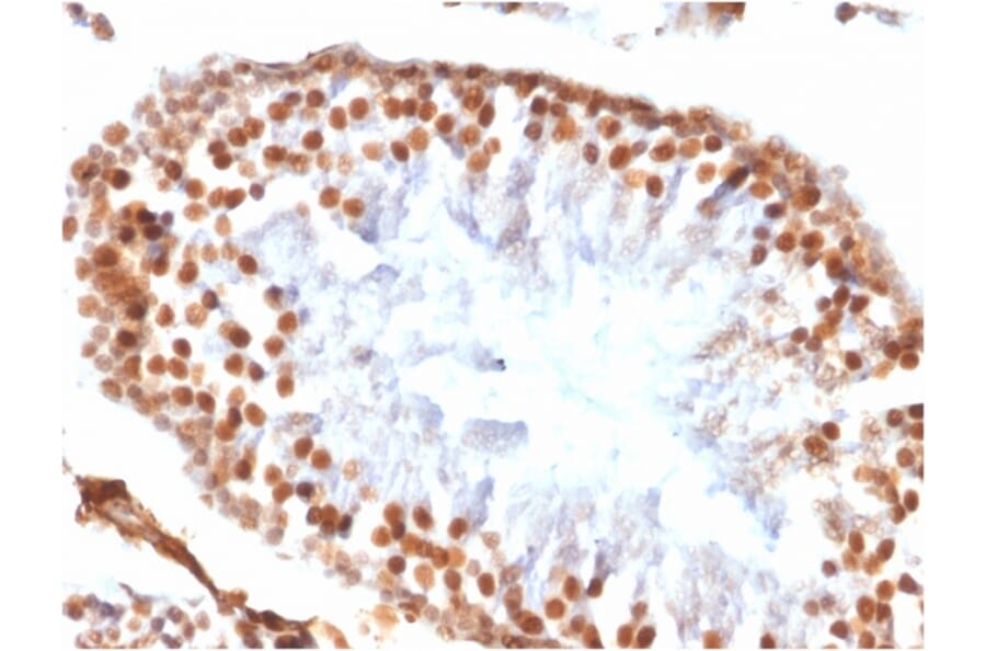 Immunohistochemistry - Anti-Wilms Tumor Protein Antibody [WT1/1434R] - BSA and Azide free (A253515) - Antibodies.com