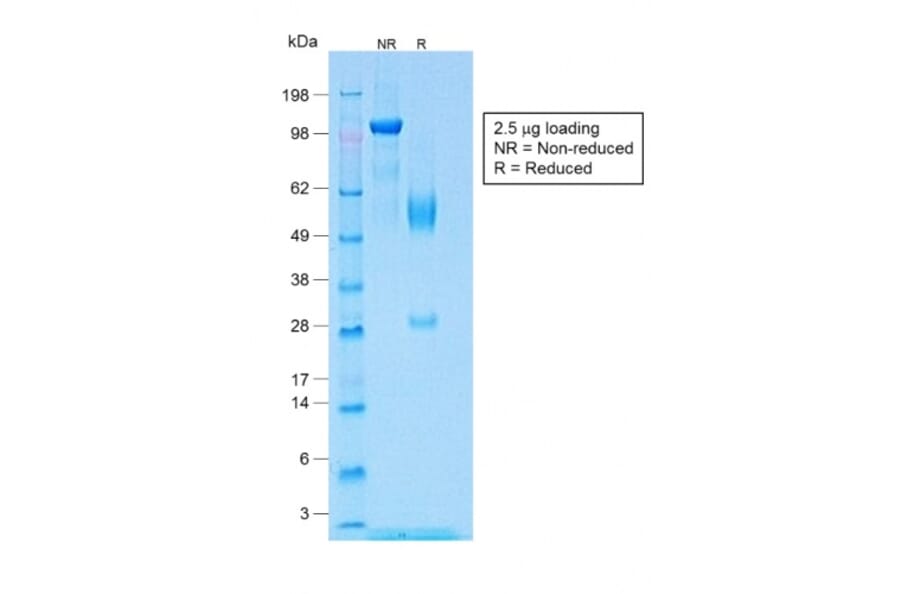 SDS-PAGE - Anti-Wilms Tumor Protein Antibody [WT1/1434R] - BSA and Azide free (A253515) - Antibodies.com