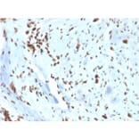 Immunohistochemistry - Anti-Wilms Tumor Protein Antibody [WT1/3477R] - BSA and Azide free (A253515) - Antibodies.com