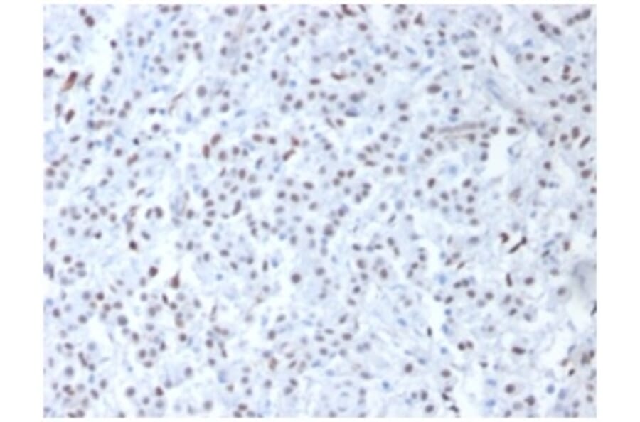 Immunohistochemistry - Anti-Wilms Tumor Protein Antibody - BSA and Azide free (A253516) - Antibodies.com