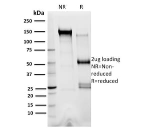 SDS-PAGE - Anti-XRCC3 Antibody [10F1/6] - BSA and Azide free (A253517) - Antibodies.com