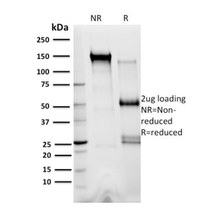 SDS-PAGE - Anti-XRCC3 Antibody [10F1/6] - BSA and Azide free (A253517) - Antibodies.com