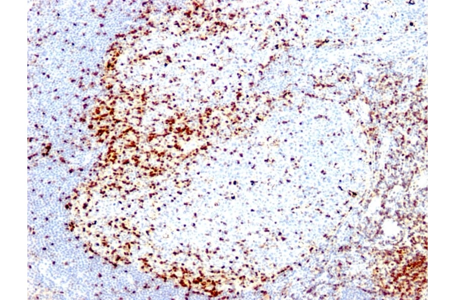 Immunohistochemistry - Anti-ZAP70 Antibody [2F3.2] - BSA and Azide free (A253520) - Antibodies.com