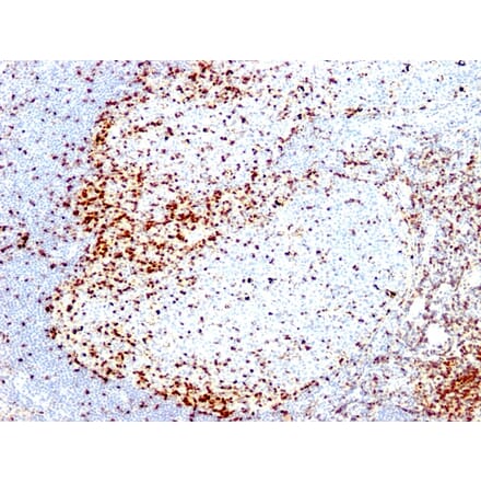 Immunohistochemistry - Anti-ZAP70 Antibody [2F3.2] - BSA and Azide free (A253520) - Antibodies.com