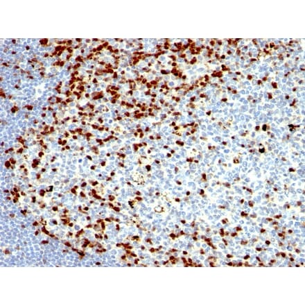 Immunohistochemistry - Anti-ZAP70 Antibody [SPM362] - BSA and Azide free (A253520) - Antibodies.com