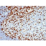 Immunohistochemistry - Anti-ZAP70 Antibody [SPM362] - BSA and Azide free (A253520) - Antibodies.com
