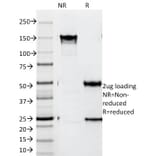 SDS-PAGE - Anti-ZAP70 Antibody [SPM362] - BSA and Azide free (A253521) - Antibodies.com