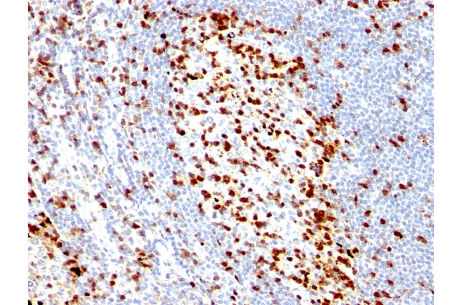 Immunohistochemistry - Anti-ZAP70 Antibody [ZAP70/528] - BSA and Azide free (A253521) - Antibodies.com