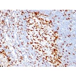 Immunohistochemistry - Anti-ZAP70 Antibody [ZAP70/528] - BSA and Azide free (A253521) - Antibodies.com