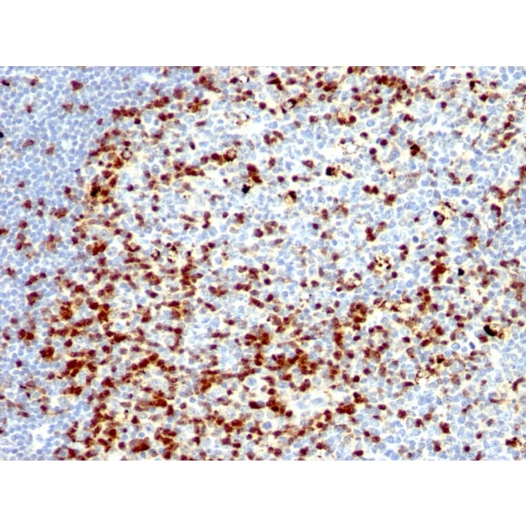 Immunohistochemistry - Anti-ZAP70 Antibody [ZAP70/528 + 2F3.2] - BSA and Azide free (A253522) - Antibodies.com